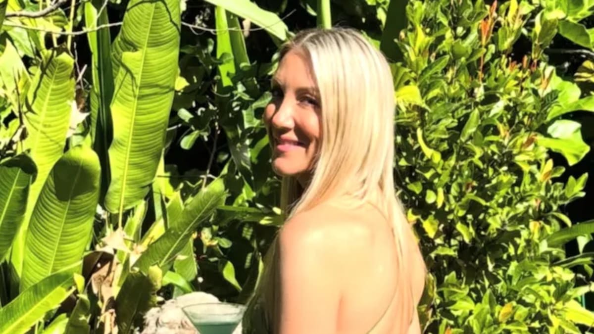 Australian Tourist Amy Donohue Faces Over A$30,000 in Medical Bills After Bali Scooter Crash