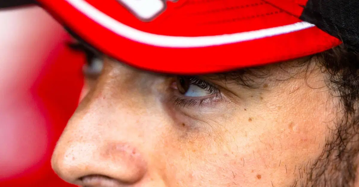 Bagnaia on Recovery From Arm Surgery: 'I Didn't Need Stoner's Opinion to Understand the Situation'